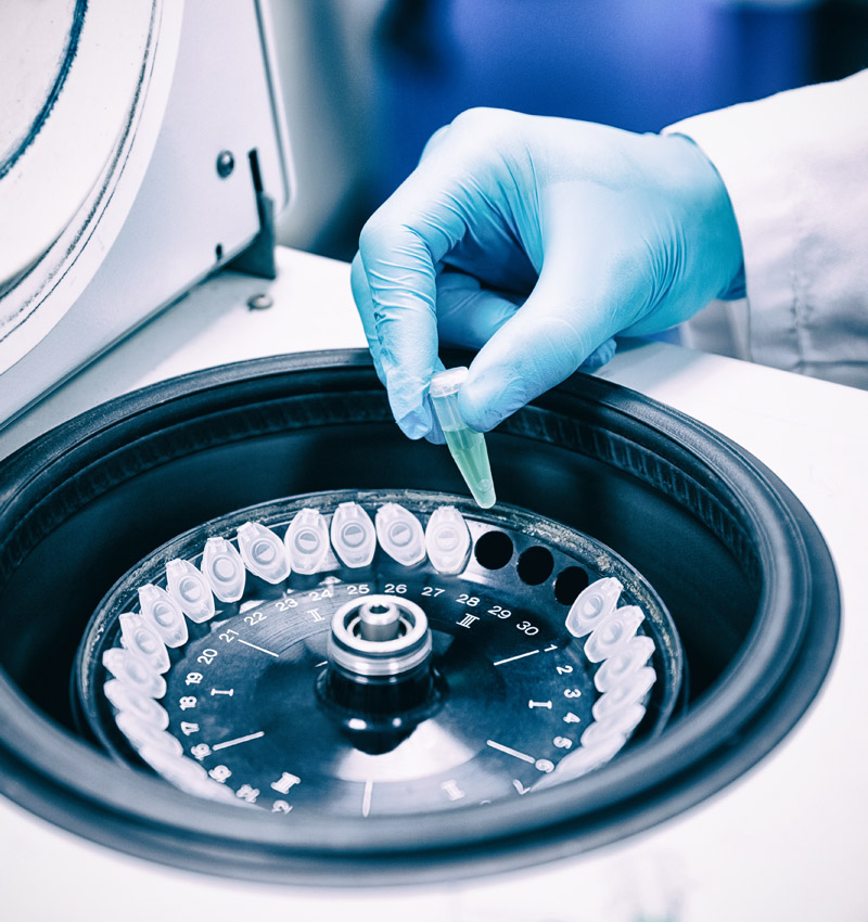 Teradata Vantage gives Siemens Healthineers the ability to monitor all the sales, sensor, supply chain and service data so Siemens Healthineers can predict, prevent and repair products.