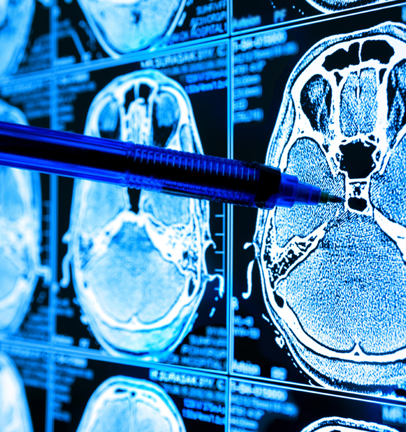 Teradata is helping Siemens Healthineers to deliver on their customer’s expectations.